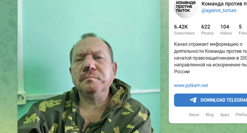 Игорь Каляпин в больнице. Фото https://t.me/s/against_torture/2203